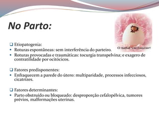 No Parto:
 Etiopatogenia:
 Roturas espontâneas: sem interferência do parteiro.
 Roturas provocadas e traumáticas: tocurgia transpelvina; e exagero de
contratilidade por ocitócicos.
 Fatores predisponentes:
 Enfraquecem a parede do útero: multiparidade, processos infecciosos,
cicatrizes.
 Fatores determinantes:
 Parto obstruído ou bloqueado: desproporção cefalopélvica, tumores
prévios, malformações uterinas.
 
