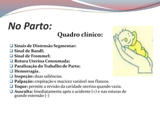 No Parto:
Quadro clínico:
 Sinais de Distensão Segmentar:
 Sinal de Bandl;
 Sinal de Frommel;
 Rotura Uterina Consumada;
 Paralisação do Trabalho de Parto;
 Hemorragia .
 Inspeção: duas saliências.
 Palpação: crepitação e macicez variável nos flancos.
 Toque: permite a revisão da cavidade uterina quando vazia.
 Ausculta: Imediatamente após o acidente (+) e nas roturas de
grande extensão (-)
 
