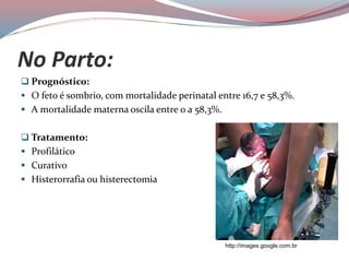 No Parto:
 Prognóstico:
 O feto é sombrio, com mortalidade perinatal entre 16,7 e 58,3%.
 A mortalidade materna oscila entre 0 a 58,3%.
 Tratamento:
 Profilático
 Curativo
 Histerorrafia ou histerectomia
http://images.google.com.br
 
