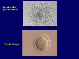 Oocytes with
granulosa cells
"Naked" Oocyte
 