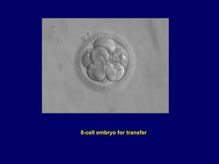 8-cell embryo for transfer
 