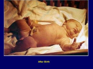 After Birth
 
