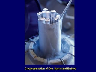 Cryopreservation of Ova, Sperm and Embryo
 