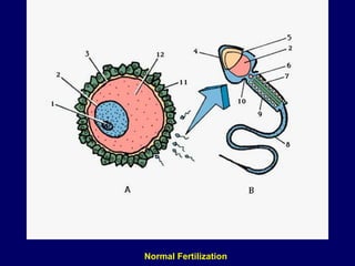 Normal Fertilization
 