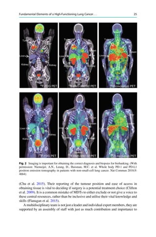 Lung Cancer Pathophysiology An Interdisciplinary Approach Nima Rezaei | PDF