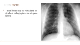 Radiographic presentation of pulmonary TB.pptx