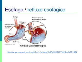 Esófago / refluxo esofágico
http://www.manualmerck.net/?url=/artigos/%3Fid%3D127%26cn%3D1081
 