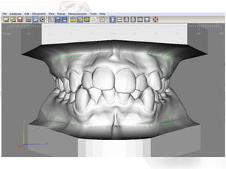 29 3 d model for problem-based and case-based learning in dentistry ...