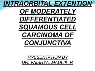 INTRAORBITAL EXTENTION
OF MODERATELY
DIFFERENTIATED
SQUAMOUS CELL
CARCINOMA OF
CONJUNCTIVA
PRESENTATION BY
DR. VAISHYA. MAULIK. P.
 