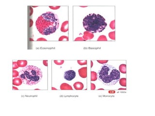 29609_Blood module 5 WBC 08.ppt blood dis | PPT