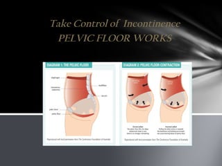 Take Control of Incontinence
PELVIC FLOOR WORKS
 