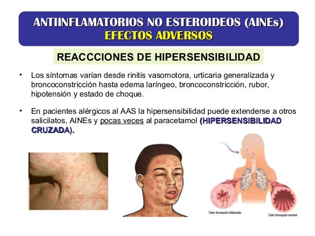 AINES AINES