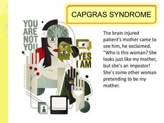 CAPGRAS SYNDROME
 