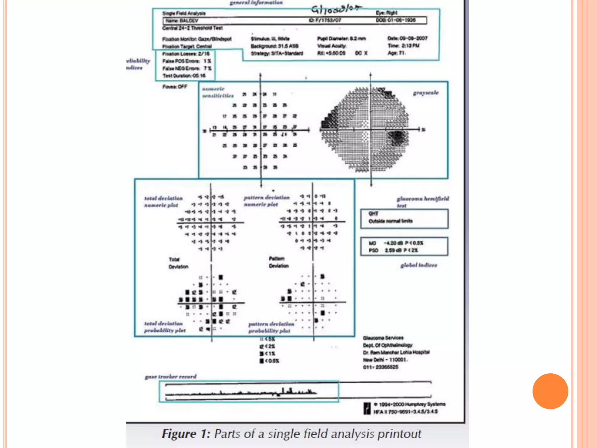 29 april VISUAL FIELD EXAMINATION..pptx