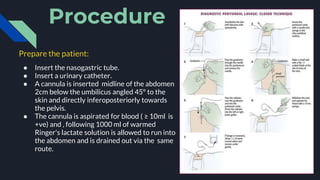 What Is Peritoneal Lavage? , Abdominal Pain Types, Symptoms, Treatment ...