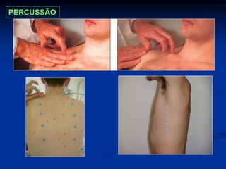 PERCUSSÃO
 