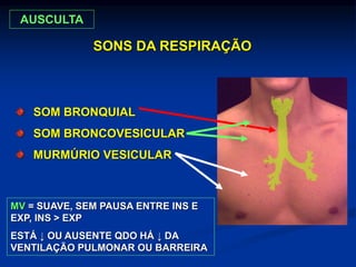 SOM BRONQUIAL
SOM BRONCOVESICULAR
MURMÚRIO VESICULAR
SONS DA RESPIRAÇÃO
MV = SUAVE, SEM PAUSA ENTRE INS E
EXP, INS > EXP
ESTÁ ↓ OU AUSENTE QDO HÁ ↓ DA
VENTILAÇÃO PULMONAR OU BARREIRA
AUSCULTA
 