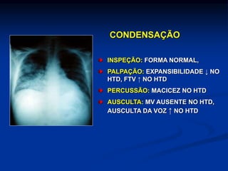 CONDENSAÇÃO
INSPEÇÃO: FORMA NORMAL,
PALPAÇÃO: EXPANSIBILIDADE ↓ NO
HTD, FTV ↑ NO HTD
PERCUSSÃO: MACICEZ NO HTD
AUSCULTA: MV AUSENTE NO HTD,
AUSCULTA DA VOZ ↑ NO HTD
 