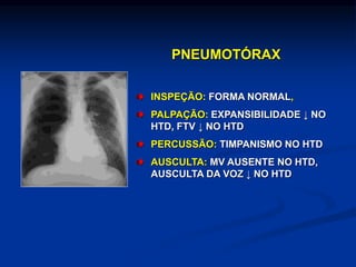 PNEUMOTÓRAX
INSPEÇÃO: FORMA NORMAL,
PALPAÇÃO: EXPANSIBILIDADE ↓ NO
HTD, FTV ↓ NO HTD
PERCUSSÃO: TIMPANISMO NO HTD
AUSCULTA: MV AUSENTE NO HTD,
AUSCULTA DA VOZ ↓ NO HTD
 