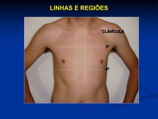 LINHAS E REGIÕES
CLAVÍCULA
3ª
6ª
 