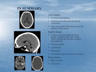 IN SUMMARY
Axial images:
• Cerebral hemispheres
• Ventricles (in this case the lateral
ventricles)
• Sulci (the small CSF spaces over the
surface of the brain)
Sagittal images:
• Corpus callosum (great band of
deeply situated transverse white
fibres uniting the two the cerebral
hemispheres)
• Pituitary gland
• Cerebellum
• Brainstem,
• Visualised spinal cord/cervical spine
Bone windows
• Base of skull
• Calvarium
 