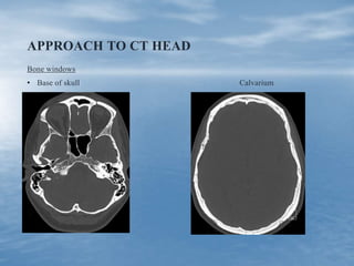 APPROACH TO CT HEAD
Bone windows
• Base of skull Calvarium
 