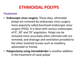 ETHMOIDAL POLYPS
Treatment:
• Endoscopic sinus surgery. These days, ethmoidal
polypi are removed by endoscopic sinus surgery
more popularly called functional endoscopic sinus
surgery (FESS). It is done with various endoscopes
of 0°, 30° and 70° angulation. Polypi can be
removed more accurately when ethmoid cells are
removed, and drainage and ventilation provided to
the other involved sinuses such as maxillary,
sphenoidal or frontal.
• Polypectomy using microdebrider is another addition
in the treatment of nasal polypi
 