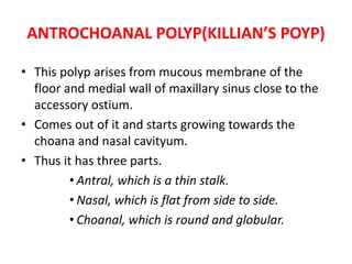 ANTROCHOANAL POLYP(KILLIAN’S POYP)
• This polyp arises from mucous membrane of the
floor and medial wall of maxillary sinus close to the
accessory ostium.
• Comes out of it and starts growing towards the
choana and nasal cavityum.
• Thus it has three parts.
• Antral, which is a thin stalk.
• Nasal, which is flat from side to side.
• Choanal, which is round and globular.
 