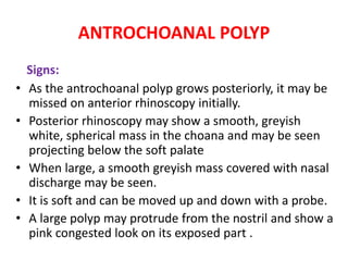 ANTROCHOANAL POLYP
Signs:
• As the antrochoanal polyp grows posteriorly, it may be
missed on anterior rhinoscopy initially.
• Posterior rhinoscopy may show a smooth, greyish
white, spherical mass in the choana and may be seen
projecting below the soft palate
• When large, a smooth greyish mass covered with nasal
discharge may be seen.
• It is soft and can be moved up and down with a probe.
• A large polyp may protrude from the nostril and show a
pink congested look on its exposed part .
 