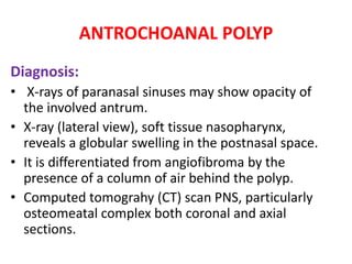 ANTROCHOANAL POLYP
Diagnosis:
• X-rays of paranasal sinuses may show opacity of
the involved antrum.
• X-ray (lateral view), soft tissue nasopharynx,
reveals a globular swelling in the postnasal space.
• It is differentiated from angiofibroma by the
presence of a column of air behind the polyp.
• Computed tomograhy (CT) scan PNS, particularly
osteomeatal complex both coronal and axial
sections.
 