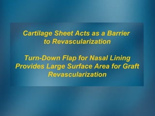 Cartilage Sheet Acts as a Barrier
to Revascularization
Turn-Down Flap for Nasal Lining
Provides Large Surface Area for Graft
Revascularization
 