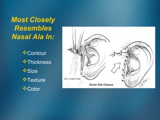 Most Closely
Resembles
Nasal Ala In:
Contour
Thickness
Size
Texture
Color
 