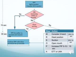 Chest
moving
HR
increasing
within 15
seconds
No
PPV for anther 15
seconds and reassess
HR
Step Action
M Consider 2-hand
R Head position
S Suction
O Open mouth
P Increase PIP 5-10 / 15
sec
A ETT or LMA
PPV 15
sec
Ye
s
Ye
s
15 sec
PPV 15
sec
30 sec
PPV
SpO2 monitor
Consider ECG monitor
Continue PPV with chest
movement for 30 seconds
 