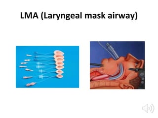 LMA (Laryngeal mask airway)
 