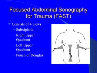 Focused Abdominal SonographyFocused Abdominal Sonography
for Trauma (FAST)for Trauma (FAST)
 Consists of 4 views
– Subxiphoid
– Right Upper
Quadrant
– Left Upper
Quadrant
– Pouch of Douglas
 