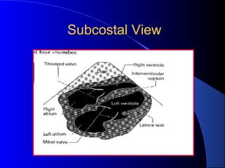 Subcostal ViewSubcostal View
 
