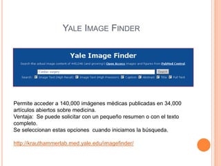 YALE IMAGE FINDER 
Permite acceder a 140,000 imágenes médicas publicadas en 34,000 
artículos abiertos sobre medicina. 
Ventaja: Se puede solicitar con un pequeño resumen o con el texto 
completo. 
Se seleccionan estas opciones cuando iniciamos la búsqueda. 
http://krauthammerlab.med.yale.edu/imagefinder/ 

