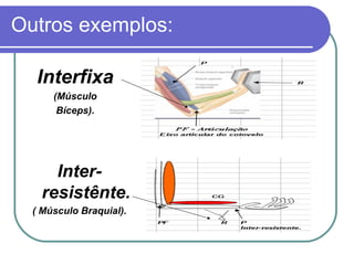 Outros exemplos: Interfixa (Músculo Bíceps). Inter-resistênte. ( Músculo Braquial). 