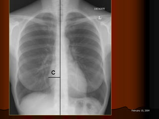 10 February 10, 2004
 