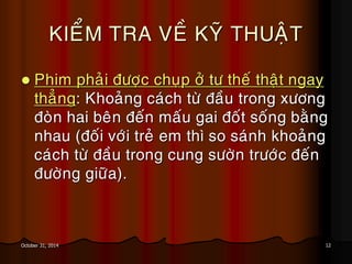 12October 31, 2014
KIEÅM TRA VEÀ KYÕ THUAÄT
 Phim phaûi ñöôïc chuïp ôû tö theá thaät ngay
thaúng: Khoaûng caùch töø ñaàu trong xöông
ñoøn hai beân ñeán maáu gai ñoát soáng baèng
nhau (ñoái vôùi treû em thì so saùnh khoaûng
caùch töø ñaàu trong cung söôøn tröôùc ñeán
ñöôøng giöõa).
 