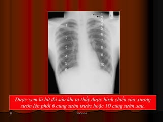 31-Oct-1417
Được xem là hít đủ sâu khi ta thấy được hình chiếu của xương
sườn lên phổi 6 cung sườn trước hoặc 10 cung sườn sau.
 