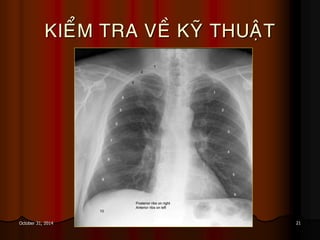 21October 31, 2014
KIEÅM TRA VEÀ KYÕ THUAÄT
 