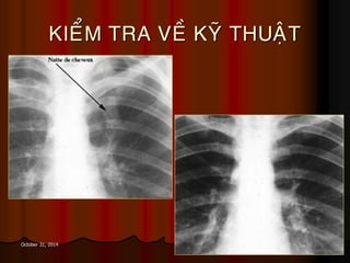 24October 31, 2014
KIEÅM TRA VEÀ KYÕ THUAÄT
 