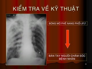 25October 31, 2014
KIEÅM TRA VEÀ KYÕ THUAÄT
BAØN TAY NGÖÔØI CHAÊM SOÙC
BEÄNH NHAÂN
BOÙNG MÔØ PHEÁ NANG PHOÅI (P)?
 