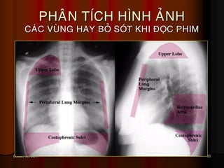 53October 31, 2014
PHAÂN TÍCH HÌNH AÛNH
CAÙC VUØNG HAY BOÛ SOÙT KHI ÑOÏC PHIM
 