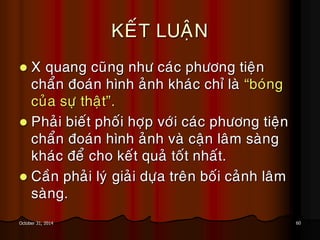 60October 31, 2014
KEÁT LUAÄN
 X quang cuõng nhö caùc phöông tieän
chaån ñoaùn hình aûnh khaùc chæ laø “boùng
cuûa söï thaät”.
 Phaûi bieát phoái hôïp vôùi caùc phöông tieän
chaån ñoaùn hình aûnh vaø caän laâm saøng
khaùc ñeå cho keát quaû toát nhaát.
 Caàn phaûi lyù giaûi döïa treân boái caûnh laâm
saøng.
 