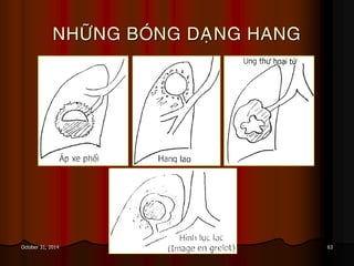 63October 31, 2014
NHÖÕNG BOÙNG DAÏNG HANG
 