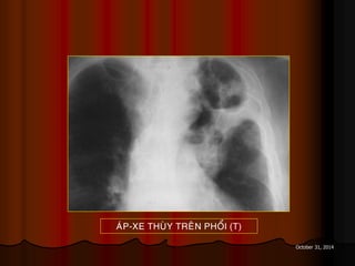 October 31, 2014
AÙP-XE THUØY TREÂN PHOÅI (T)
 