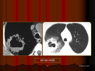 67 October 31, 2014
AÙP-XE PHOÅI
 