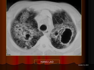 October 31, 2014
HANG LAO
 